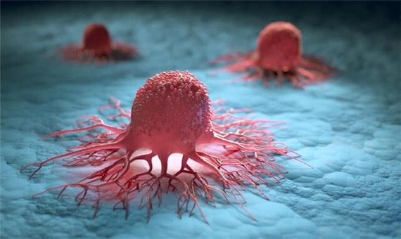 درمان سرطان با احیای سلول‌های ایمنی قوی