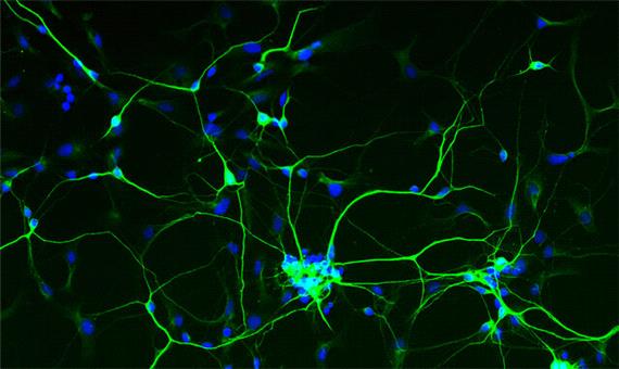 نقش سلول‌های بنیادی در درمان بیماران اعصاب