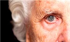 آب سیاه عامل اصلی از دست دادن بینایی