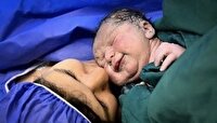 زایمان طبیعی بی‌درد؛ ایمنى مادر و نوزاد