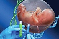 غربالگری پیش از تولد حذف نشده است