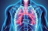 شناسایی و آغاز درمان ۹۱ بیمار مبتلا به سل در منطقه ثامن مشهد
