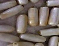 کشف ۲۳ بسته هروئین از معده یک تبعه افغان در مرز دوغارون تایباد