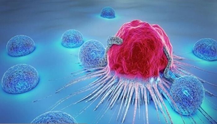 کاهش سن ابتلا به سرطان در ایران