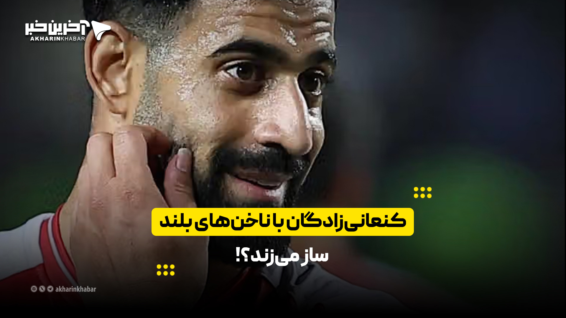 کنعانی‌زادگان با ناخن‌های بلند ساز می‌زند؟!