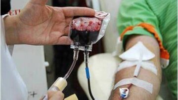 سه هزار بیمار تالاسمی قزوین چشم‌انتظار خیرین هستند